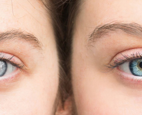 gazi-hastanesi-katarakt