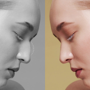 gazi-hastanesi-burun-estetiği