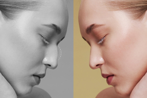 gazi-hastanesi-burun-estetiği