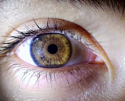 Göz Hastalıkları - Daltonizm