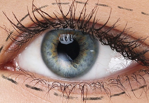 Oküloplastik Cerrahi