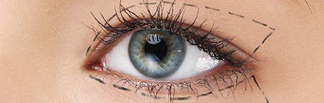 Oküloplastik Cerrahi