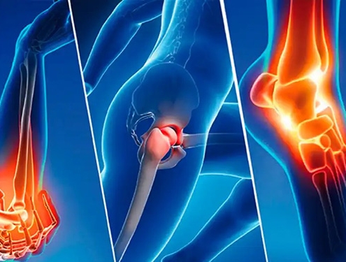 Ortopedi ve travmatoloji