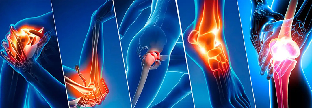 Ortopedi ve travmatoloji