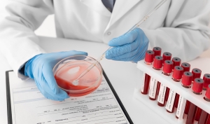 gazi-hastanesi-hematoloji