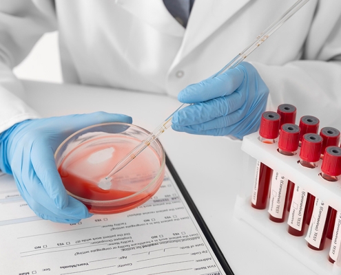 gazi-hastanesi-hematoloji