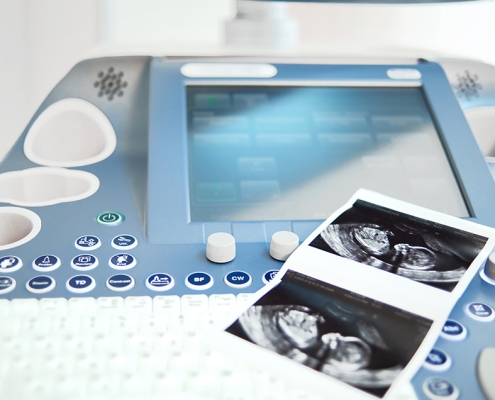 gazi-hastanesi-ultrasonografi