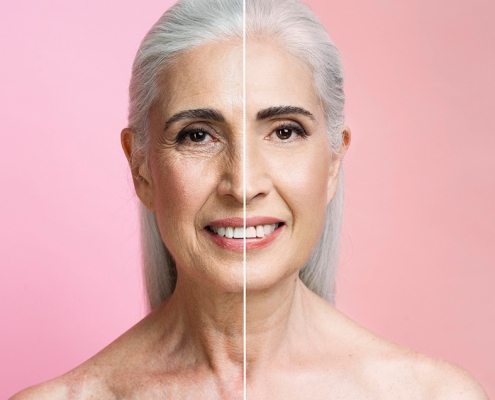 gazi-hastanesi-yuz-germe