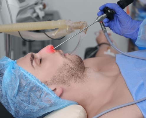 Endoskopik Sinüs Cerrahisi (ESC)